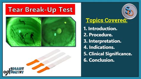 tear breakup time tbut test|tear film break up time test.